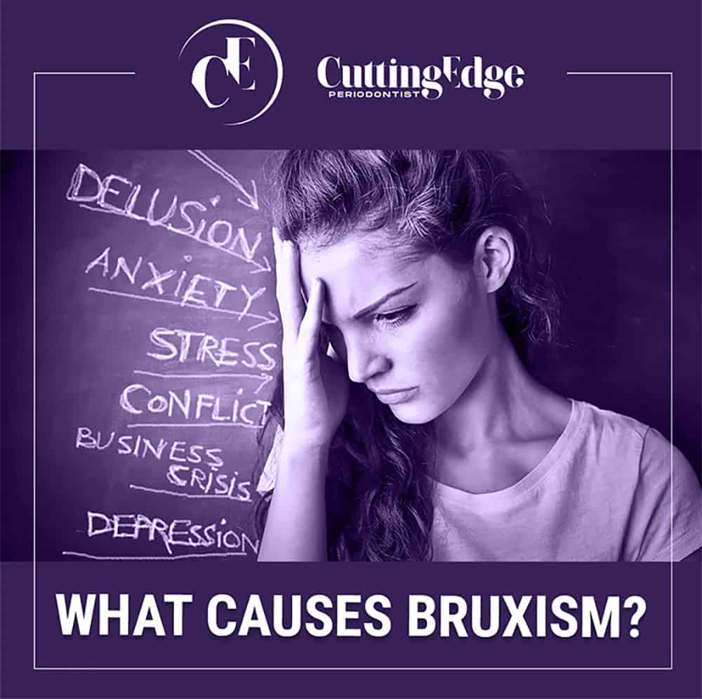 What Causes Bruxism? - Cutting Edge Periodontist Glendale