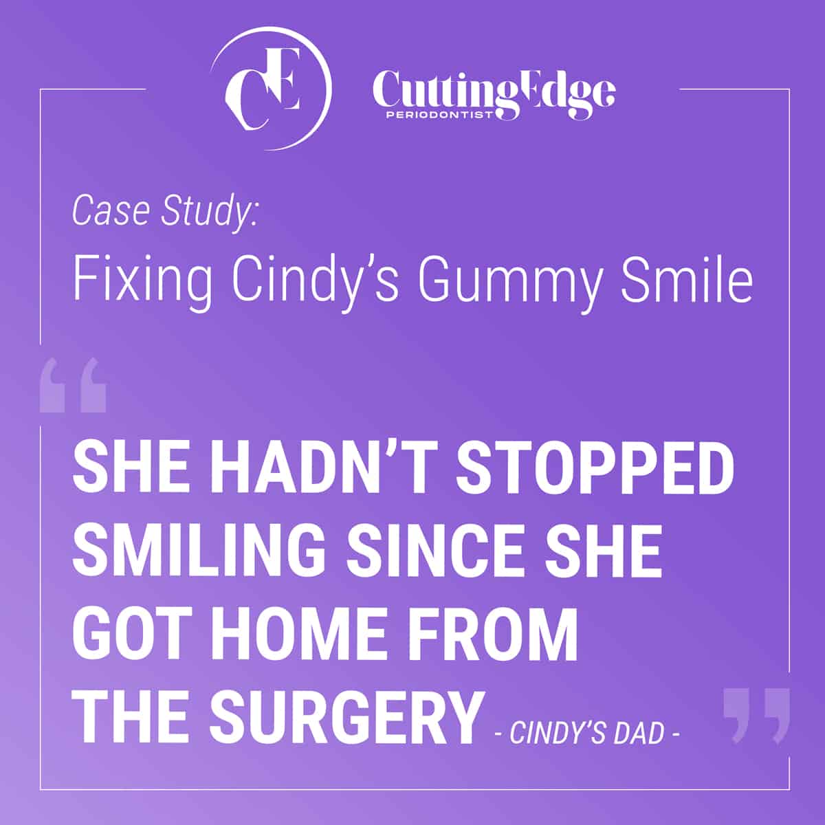 Gummy Smile - Cutting Edge Periodontist - Burbank