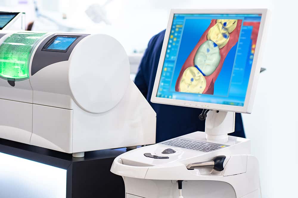 Intraoral Scanners and Dental Technology