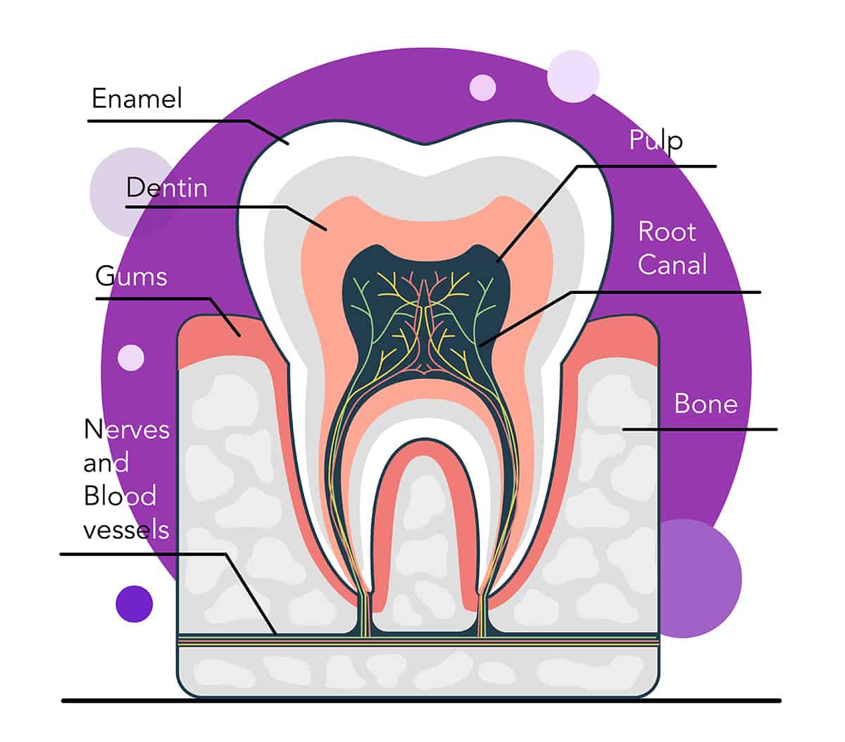 Stages of Tooth Decay - Cutting Edge Periodontist - Burbank, CA